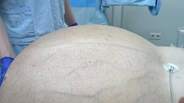 На Урале врачи удалили у мужчины опухоль весом более 60 килограммов
