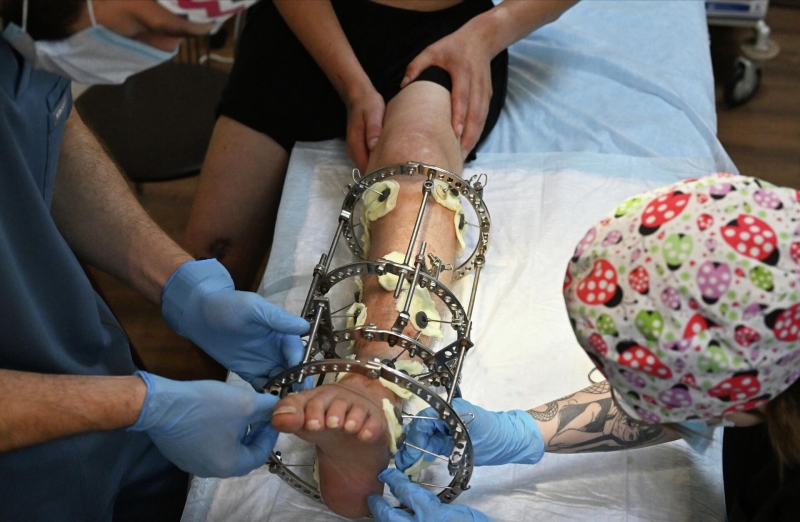 "Смеются и показывают пальцем". Как живут люди с неизлечимым заболеванием