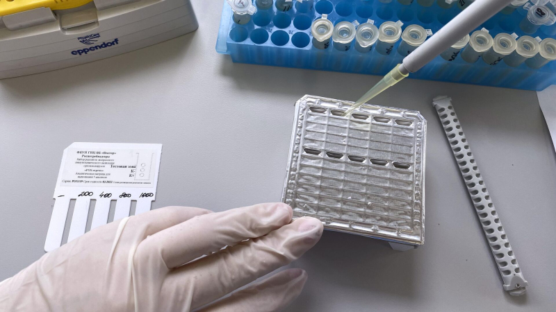 В Роспотребнадзоре рассказали, где можно заразиться оспой обезьян